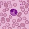 Eosinophils definition, structure, function and related disorders