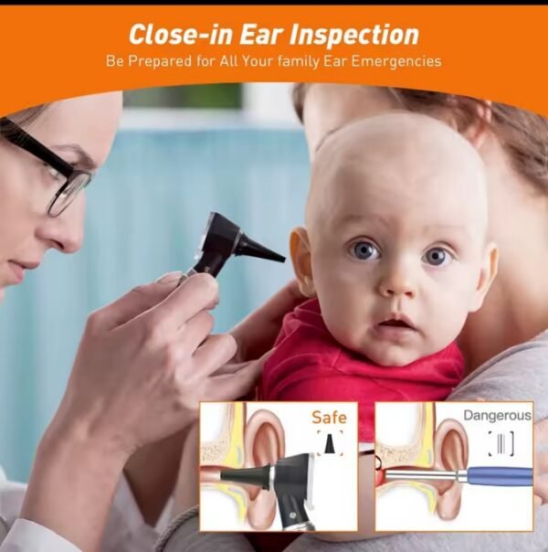 Fiber Mini Otoscope - Ear Scope with Light - Ear infection Detector - with 3x Magnify Lens - Image 2