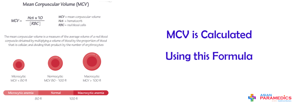 Mean Corpuscular Volume