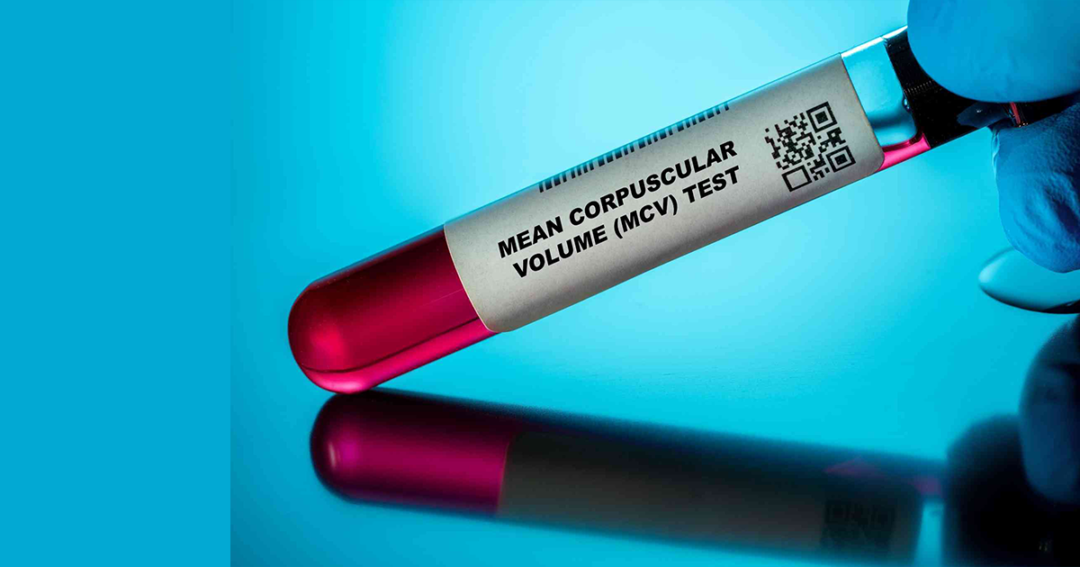 Mean Corpuscular Volume (MCV)